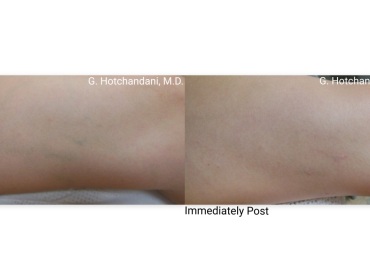 vascular_conditions_before_and_after-2