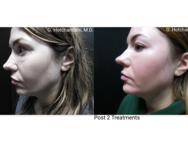 skin_rejuvenation_before_and_after-1