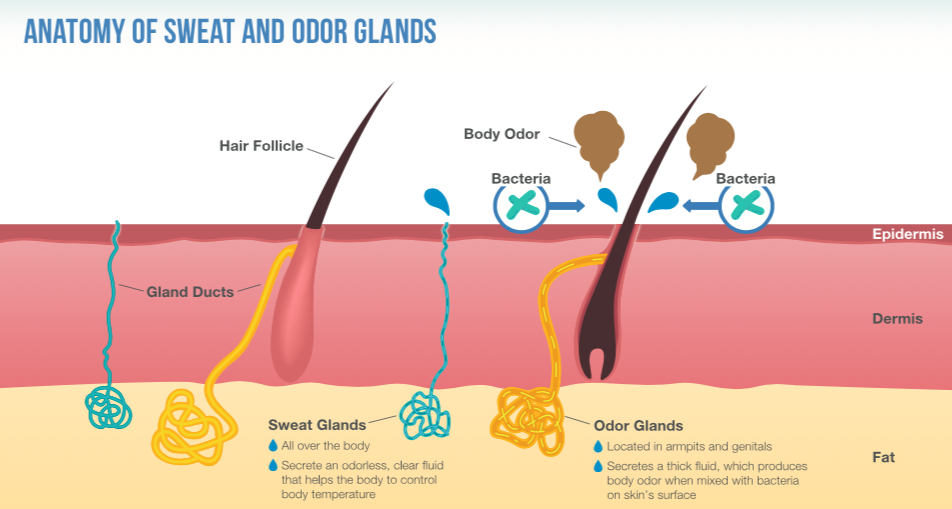 excessive sweating treatments