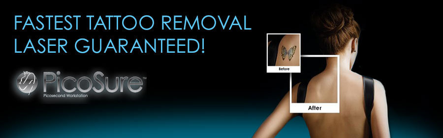 PicoSure laser tattoo removal Wisconsin